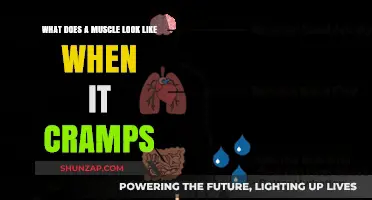 Understanding Muscle Cramps: A Visual Guide to Their Appearance