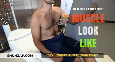 Pulled Chest Muscle Symptoms: Visual Signs and What to Expect