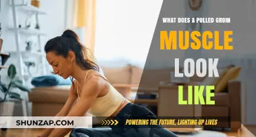 Pulled Groin Muscle: Symptoms, Appearance, and Recovery Explained