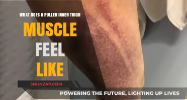 Pulled Inner Thigh Muscle: Symptoms, Pain, and Recovery Explained