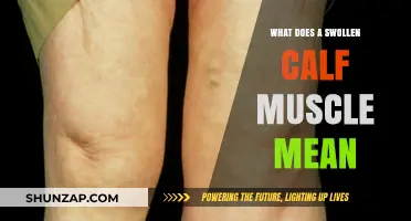 Understanding Swollen Calf Muscles: Causes and Remedies
