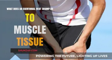 Unraveling the Impact of Exertional Heat Cramps on Muscle Tissue