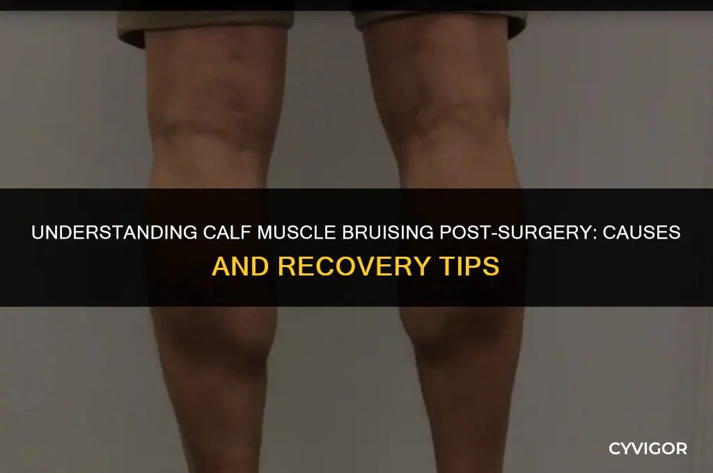 what does bruising n your calf muscles mean after surgery