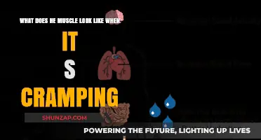 Understanding Muscle Cramps: A Visual Guide to Their Appearance