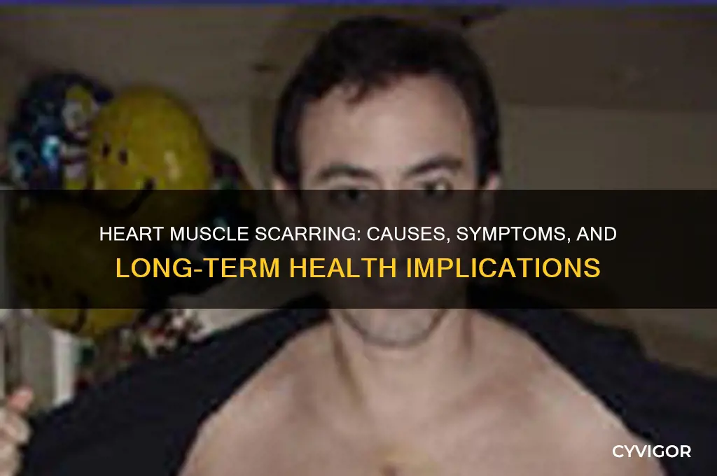what does heart muscle scarring cause