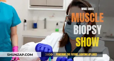 Muscle Biopsy: What Does it Reveal?