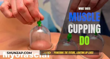 Muscle Cupping: Ancient Therapy for Modern Athletes