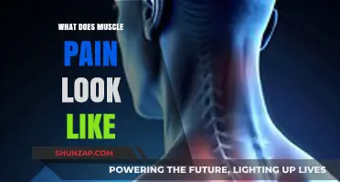 Understanding Muscle Pain: Symptoms, Causes, and Visual Indicators Explained