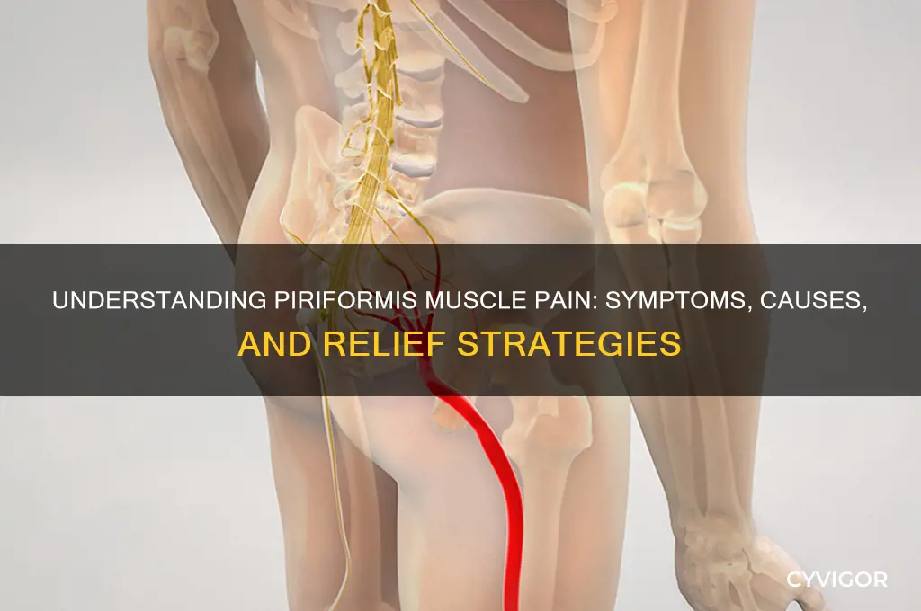 what does piriformis muscle pain feel like