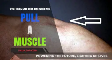 Pulled Muscle Skin Appearance: What to Expect and Why