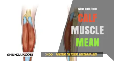Understanding a Torn Calf Muscle: Causes, Symptoms, and Recovery