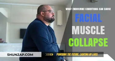 Endocrine Disorders Linked to Facial Muscle Collapse: Causes Explained