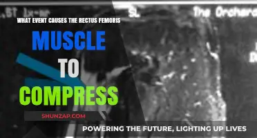 Rectus Femoris Compression: Understanding the Triggering Event and Causes
