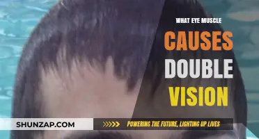 Understanding Double Vision: The Role of the Eye Muscle