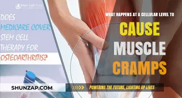 Unraveling Muscle Cramps: Cellular Mechanisms Behind the Painful Spasms