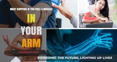 Pulled Arm Muscle: Symptoms, Recovery, and Prevention Tips Explained