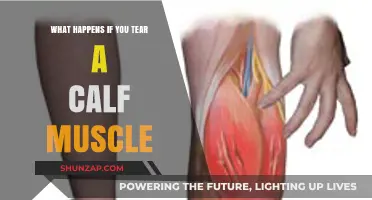 Understanding the Consequences: What Happens If You Tear a Calf Muscle?