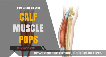 Calf Muscle Pop: Causes, Symptoms, and Recovery Tips
