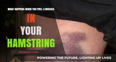 Pulled Hamstring: Symptoms, Causes, and Recovery Tips Explained