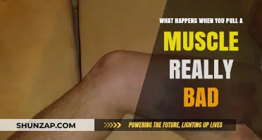Severe Muscle Pulls: Symptoms, Recovery, and Prevention Explained