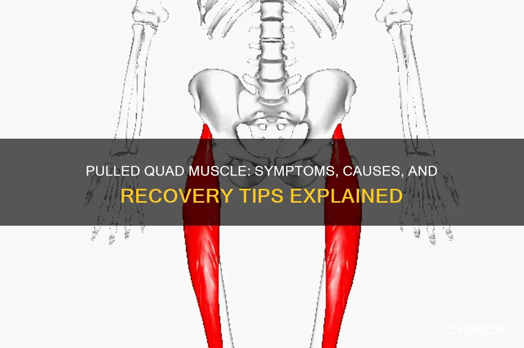 what happens when you pull your quad muscle