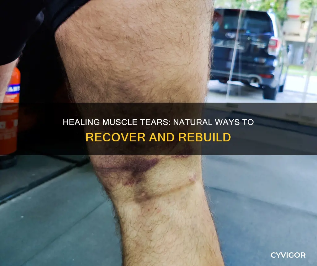 what heals muscle tears