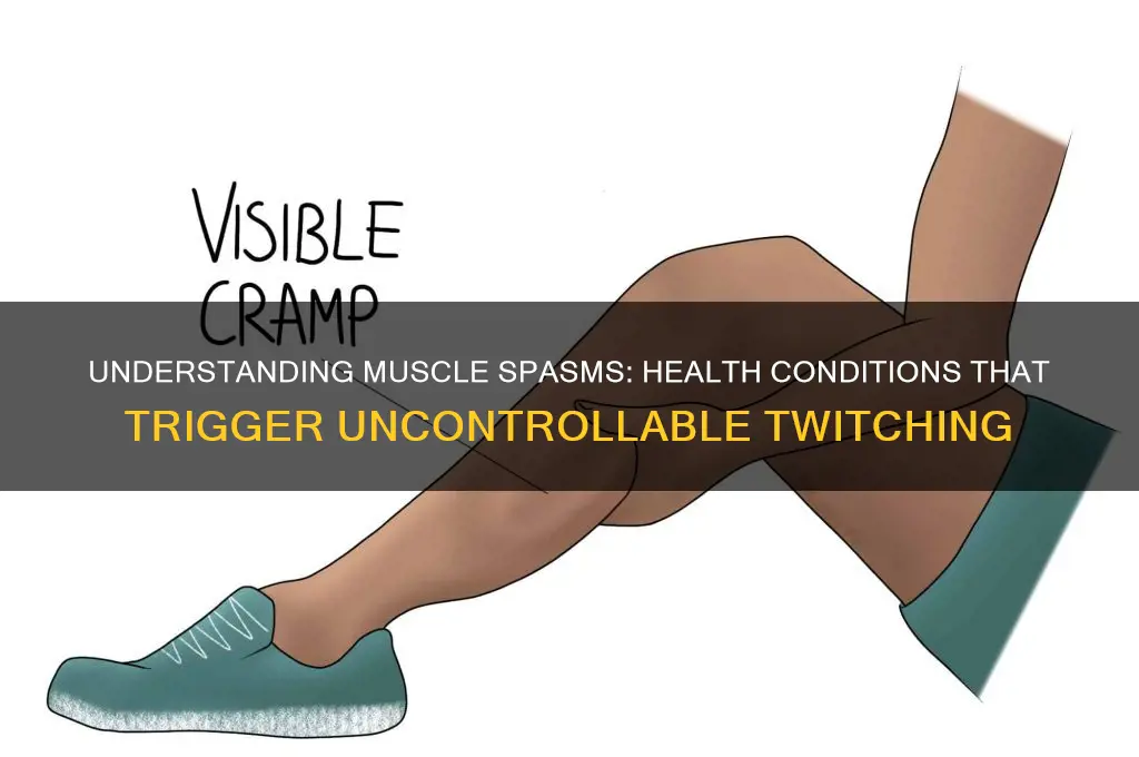 what health conditions cause muscle spasms