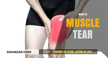 Muscle Tears: Understanding the Cause and Impact