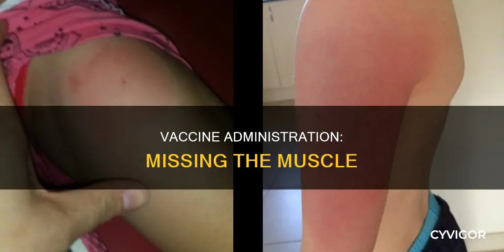 what if vaccine misses muscle