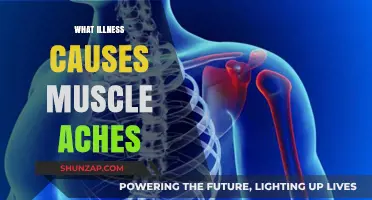 Understanding Muscle Aches: Common Illnesses That Cause Body Pain