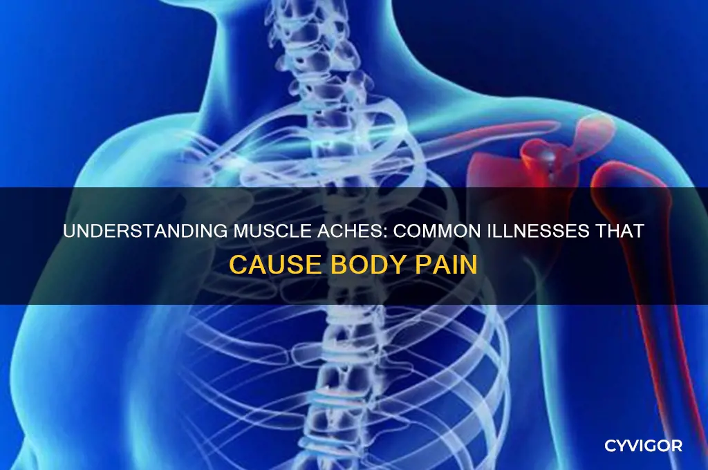 what illness causes muscle aches