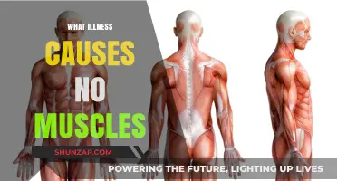 Understanding the Rare Condition That Leads to Muscle Loss