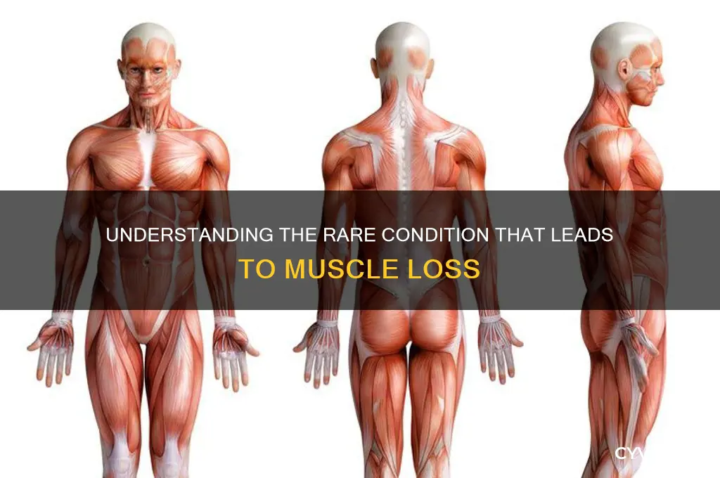 what illness causes no muscles