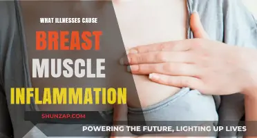 Breast Muscle Inflammation: Understanding Causes and Related Illnesses