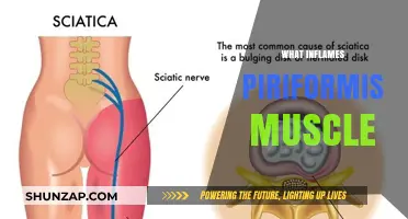 Piriformis Pain: What Triggers the Inflammation?