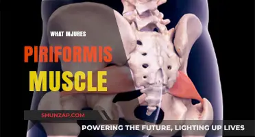 Piriformis Injuries: Causes and Prevention