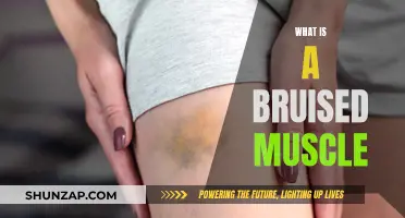 Muscle Bruises: Understanding the Pain and Healing Process