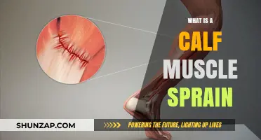 Understanding Calf Muscle Sprains: Causes, Symptoms, and Treatment