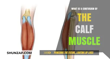 Understanding Calf Muscle Contusions: Causes, Symptoms, and Treatment