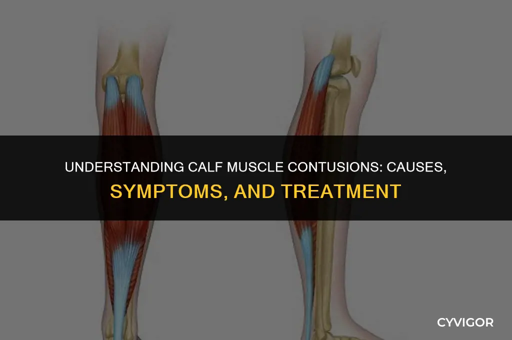 what is a contusion of the calf muscle