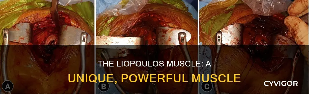 what is a liopoulos muscle