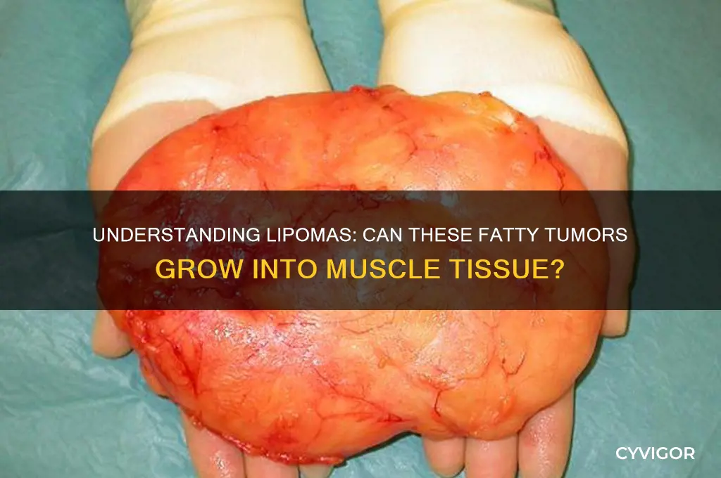 what is a lipoma grow into muscle