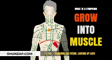 Understanding Lymphoma Growth: Can It Invade Muscle Tissue?