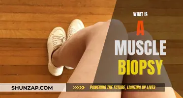 Muscle Biopsy: Understanding the Procedure and Its Benefits