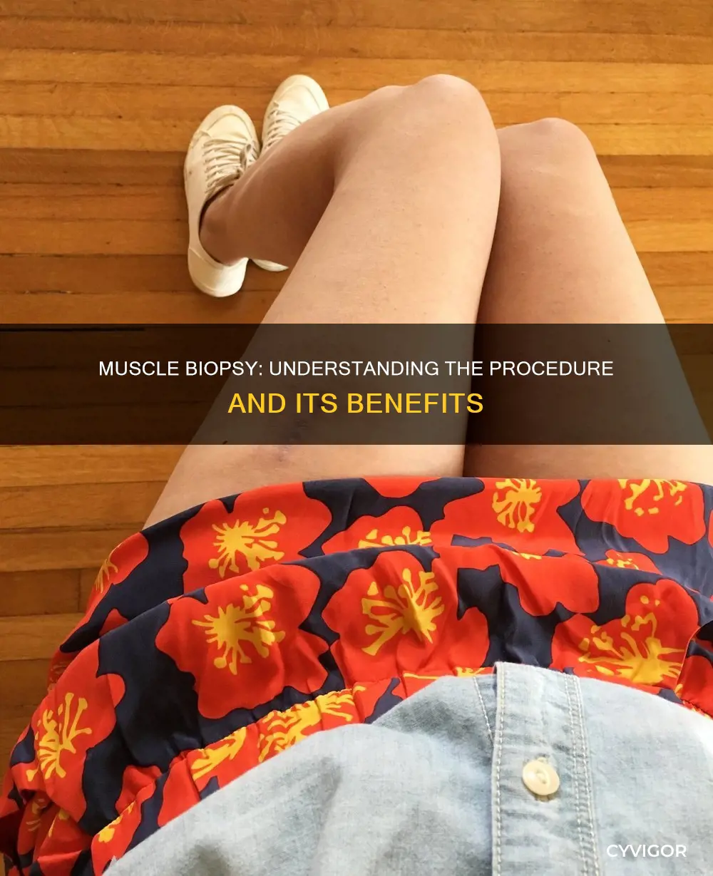 what is a muscle biopsy