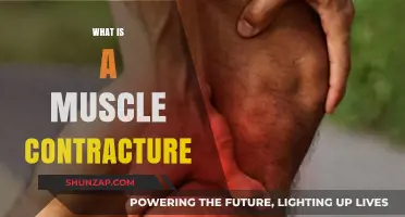 Understanding Muscle Contracture: Causes, Symptoms, and Treatment
