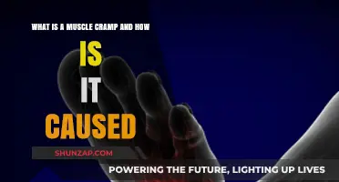 Understanding Muscle Cramps: Causes and Triggers Explained Simply