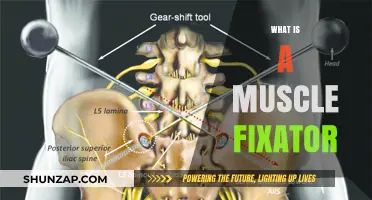 Muscle Fixators: How Do They Work?