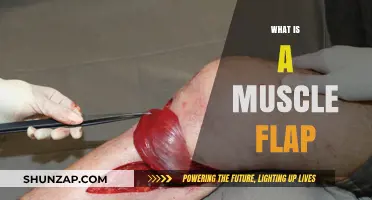 Muscle Flap Surgery: Understanding the Procedure