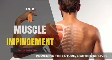 Muscle Impingement: Understanding the Pain and Treatment